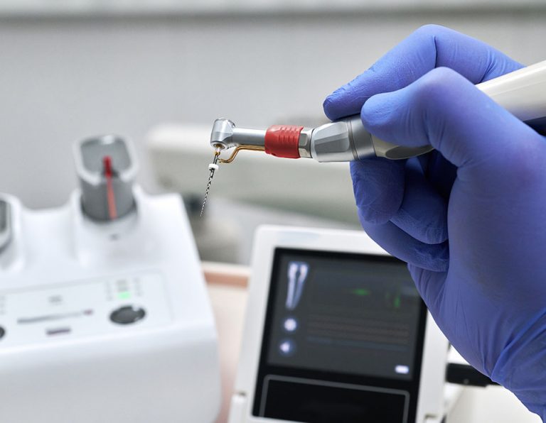 Endodontics Dr.L.P. Mohan's Dental Hospital